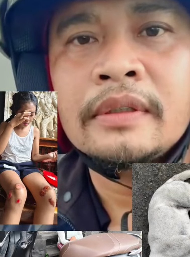 TANGKAPAN LAYAR: Tangkapan layar  anak yang terjatuh karena menabrak anjing berkeliaran di jalanan.