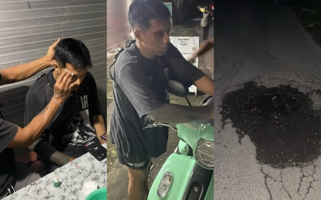 Seorang driver ojol alami kecelakaan karena jalan berlubang di Gianyar