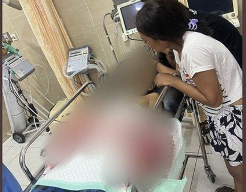 KENA MESIN: Anak 14 tahun yang tangannya tergilas mesin pencacah sampah