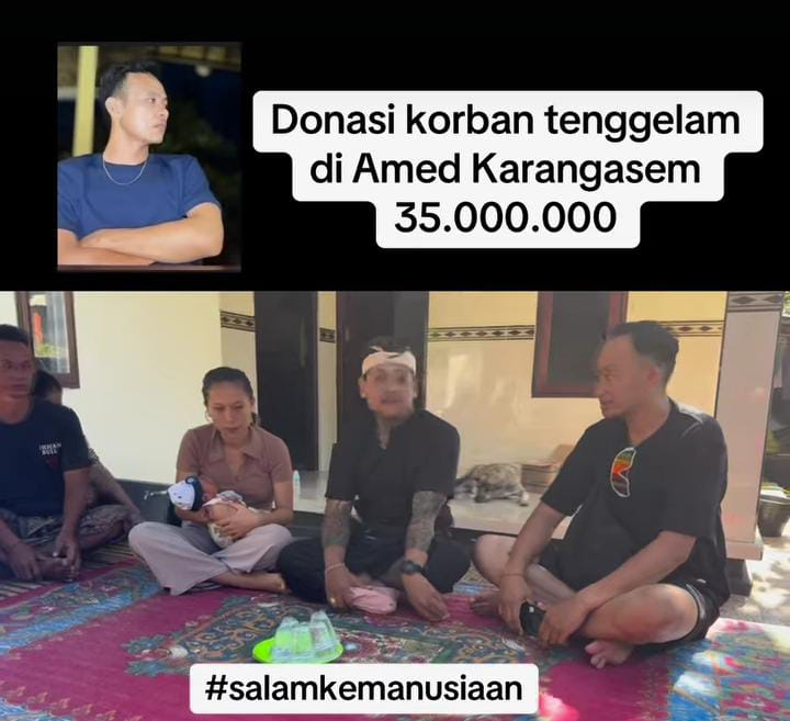 Nang Etonk Serahkan Donasi untuk Anak Ketut Sudika