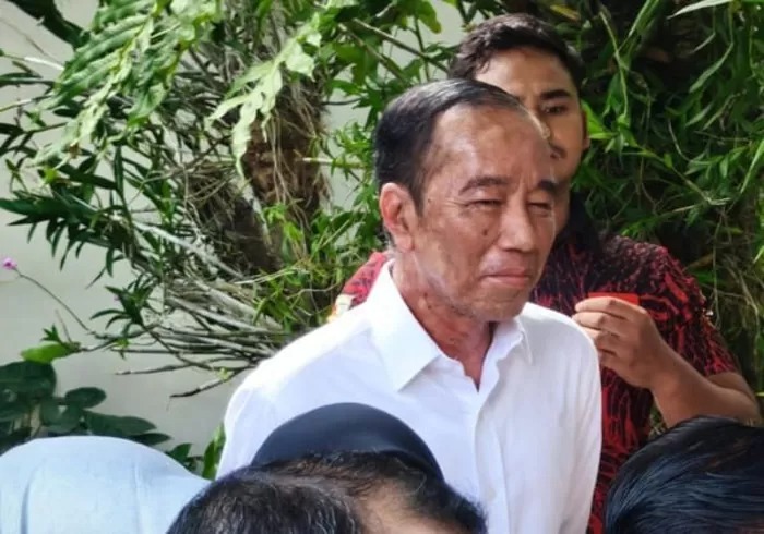 JOKOWI: Kondisi kesehatan Presiden ke-7 RI Joko Widodo (Jokowi) menjadi perhatian publik, dituding alami Sindrom Stevens-Johnson (SJS).