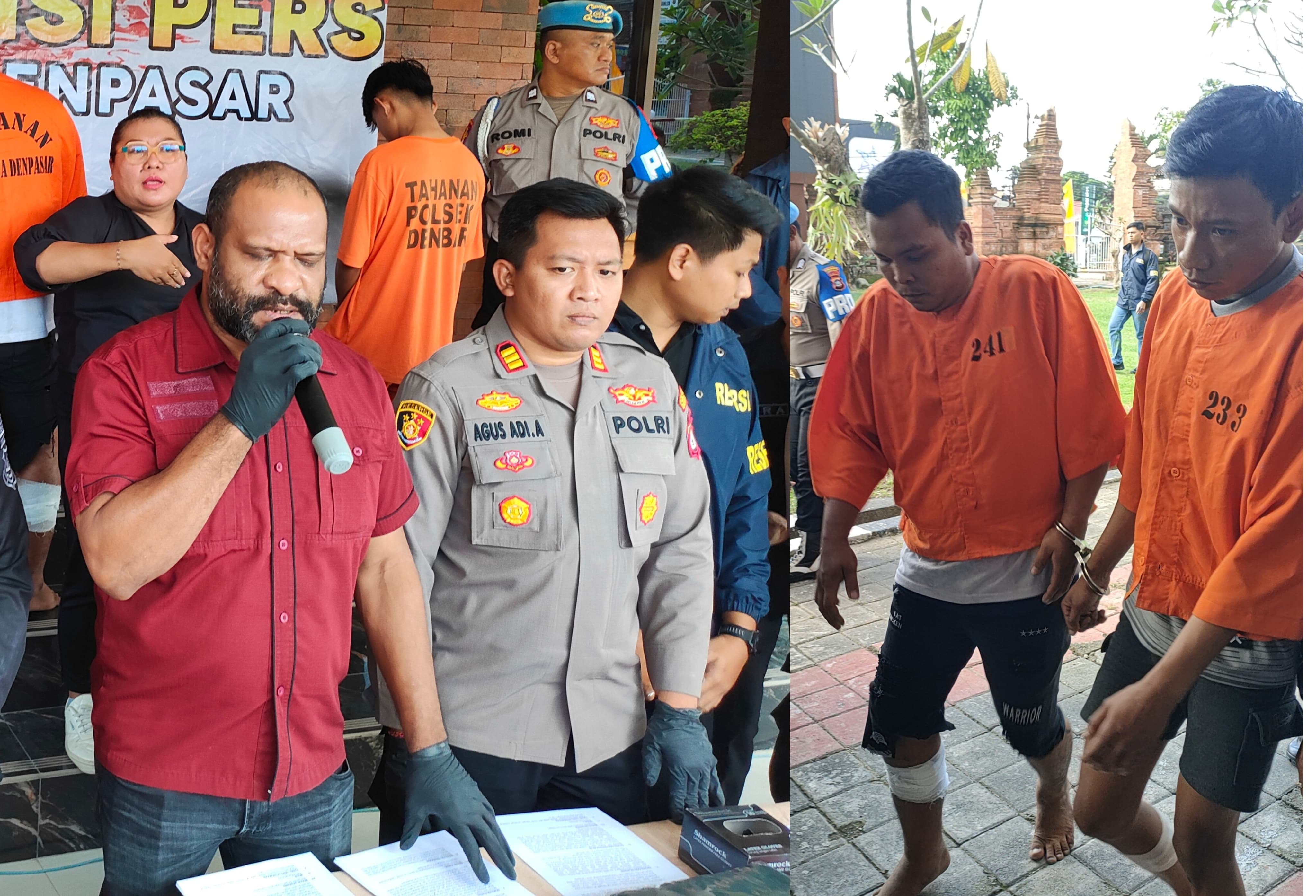Faisol Agustian, 28, dan Fani Obiansah, 23, (kanan) tampak mengenakan perban pada masing-masing betis karena didor polisi. (Bali Express/Agung Bayu)
