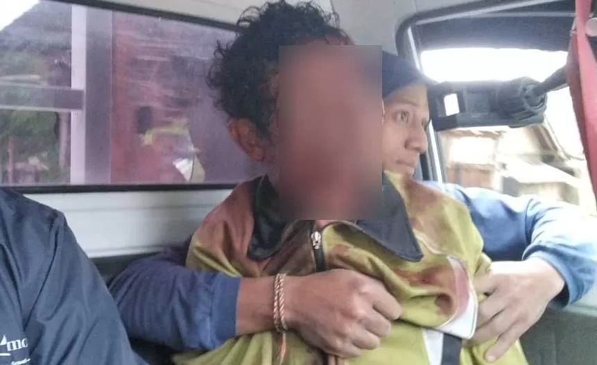 Kondisi I Nengah Rauh usai dianiaya istrinya sendiri pakai linggis di Karangasem, Bali, Jumat (18/7/2025).
