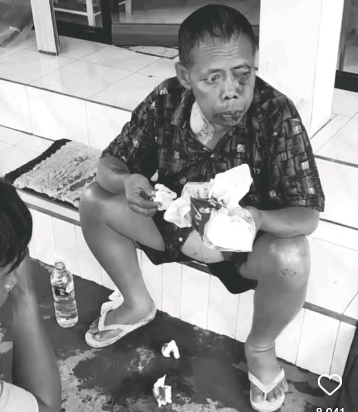 Nyawa I Wayan Kajeng Tak Tertolong usai alami kecelakaan