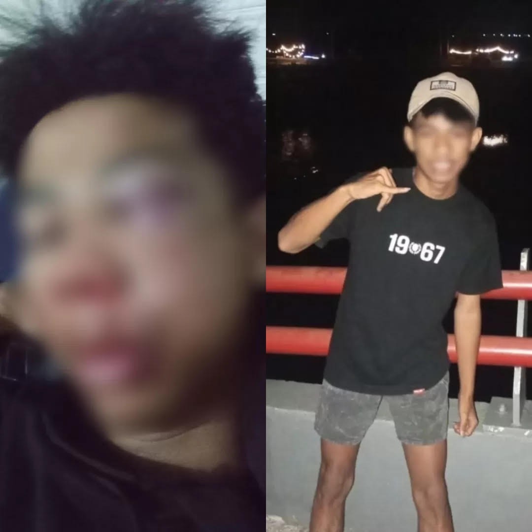 Kondisi korban remaja asal Lamongan yang bonyok usai dikeroyok gangster di Jembatan Ploso Jombang.