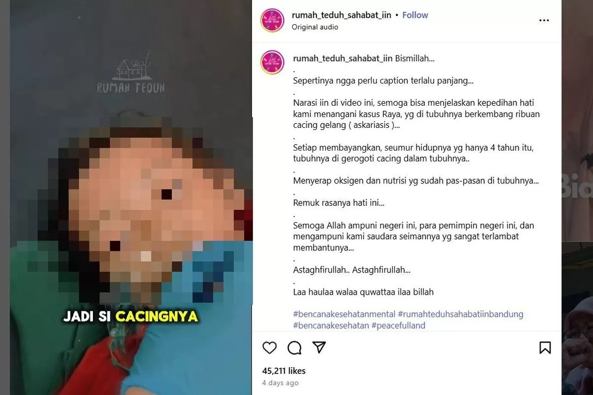 Kisah Tragis Bocah Raya, Meninggal Usai Tubuh Dipenuhi Cacing