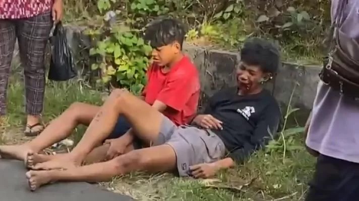Dua korban tabrak lari di Buleleng ditinggalkan di jalanan sepi