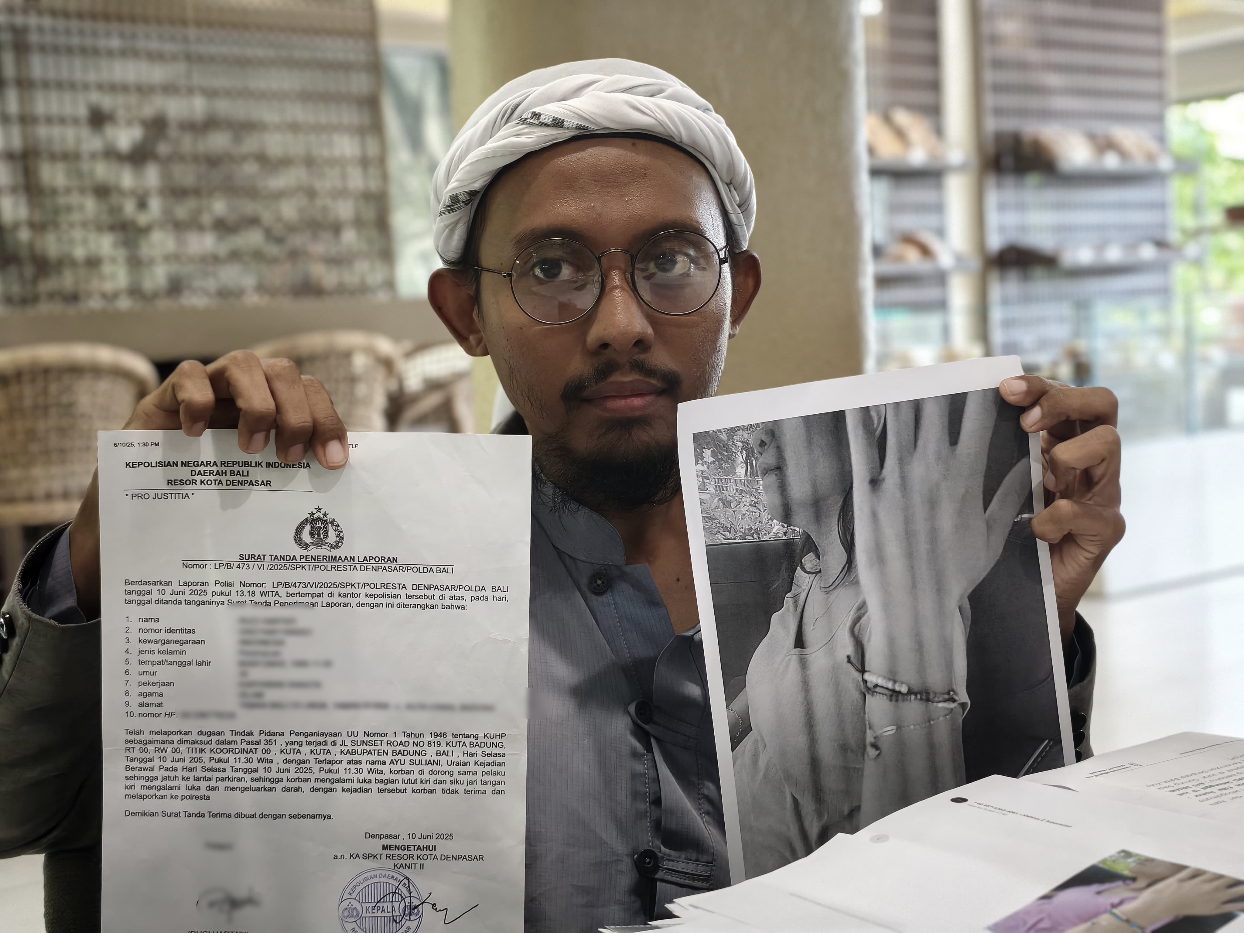 Kuasa Hukum Korban Dugaan Penganiayaan Mahrus Zakir Wahyudi, menunjukan bukti laporan. (Bali Express/I Gede Paramasutha)