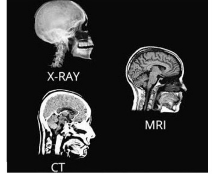Pemeriksaan Radiologi Rontgen, CT Scan, dan MRI