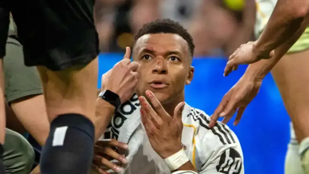Kylian Mbappe mengalami cedera wajah terkena siku pemain Girona. (Sport Mole)

