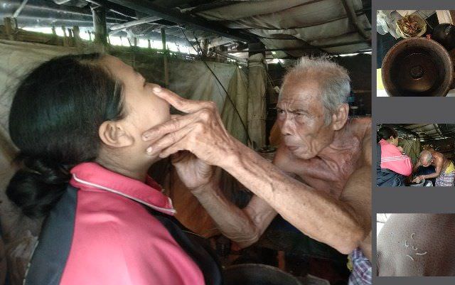Pengobatan Tradisional Ulat Gigi, masih Ada dan Diminati