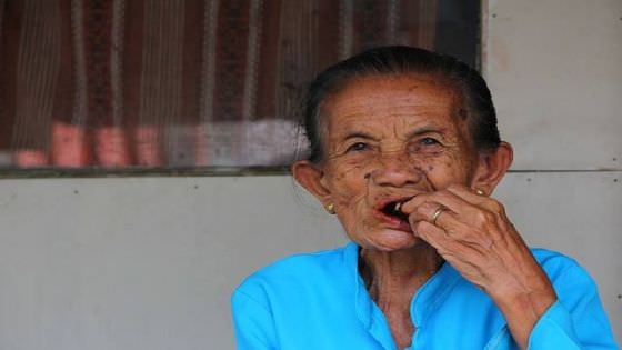 Nginang, Cara Jaga Kesehatan Gigi dan Mulut yang Terpinggirkan