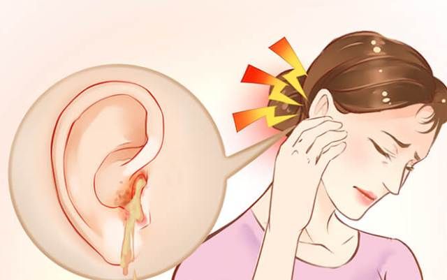 Waspadai, Curek adalah Penyakit Mahal yang Berpotensi Kematian