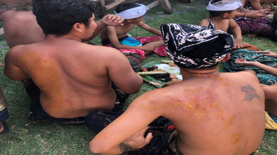BOREH KARE: Luka perang pandan langsung diobati dengan boreh kare. I Wayan Adi Prabawa/ Bali Express