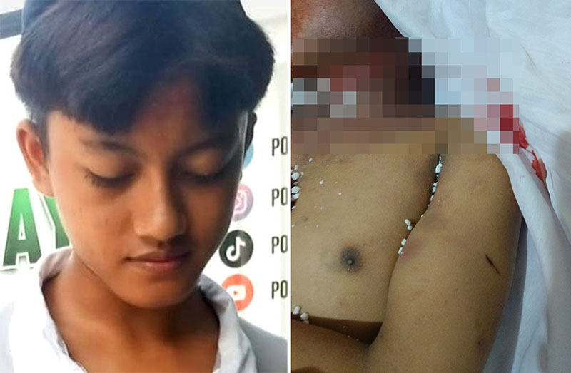 Santri BBM semasa hidup yang belajar di Ponpes Al Islahiyah, Desa Kranding, Kecamatan Mojo, Kediri (kiri). Tubuh BBM penuh luka saat diantar pulang ke rumahnya di Glenmore.