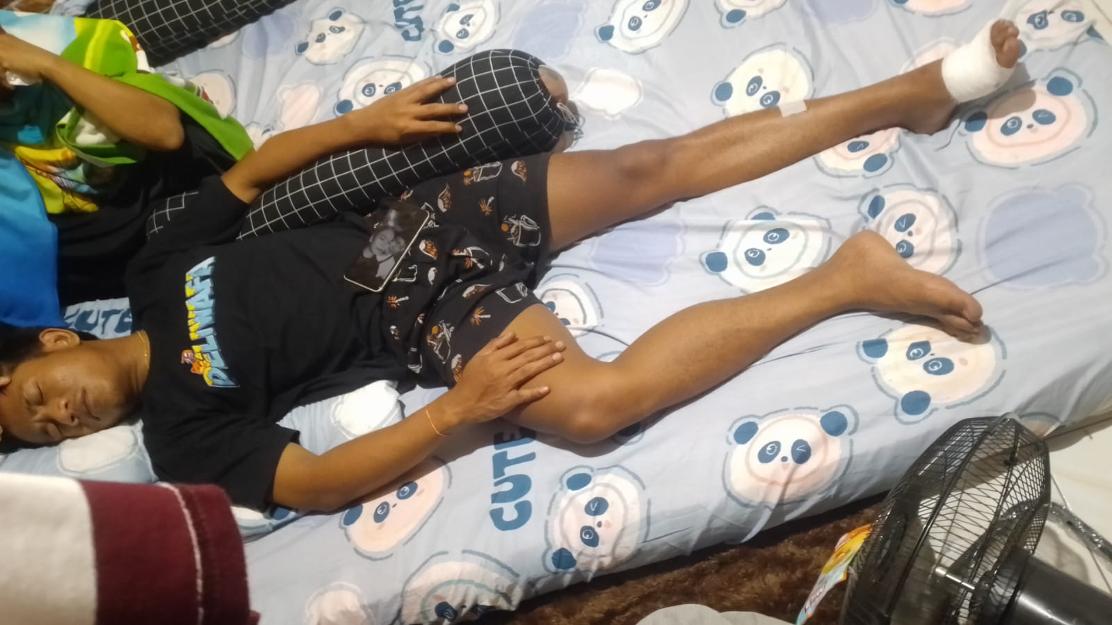 Korban Holif yang dibacok anak di bawah umur. (Khoirul Rizal/RadarSitubondo.id)