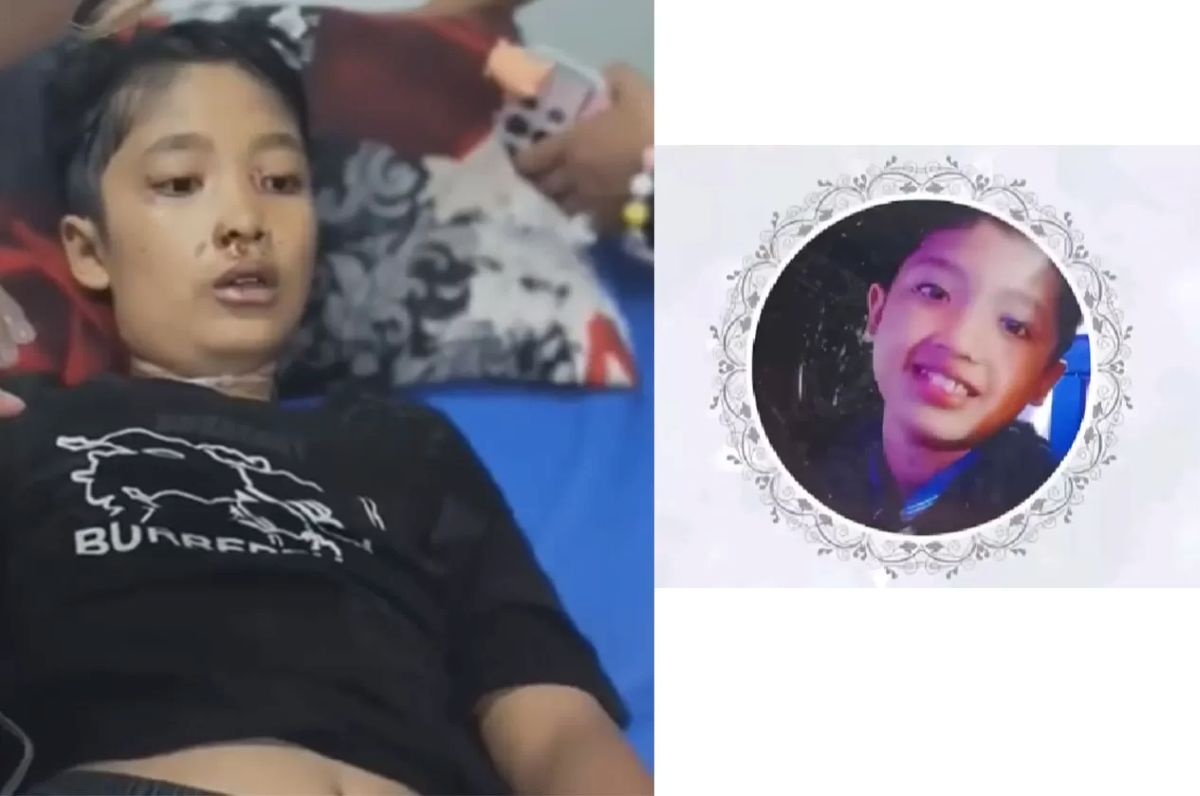 Nizam Syafei, bocah 12 tahun yang diduga dianiaya ibu tiri hingga meninggal dunia.