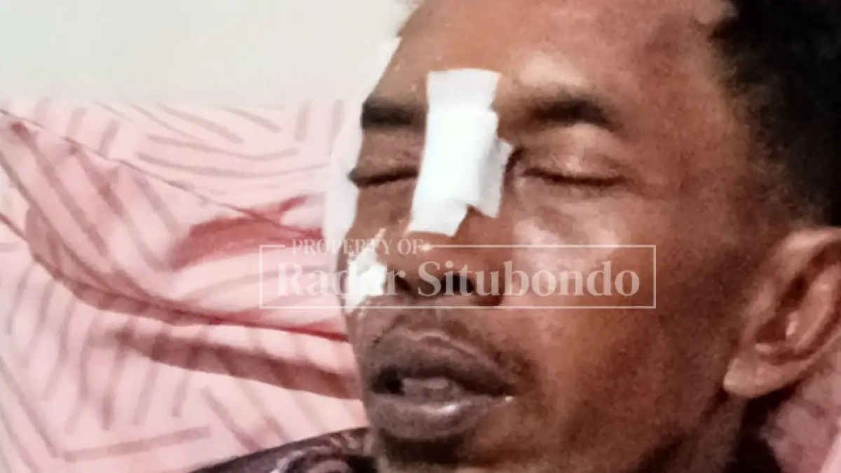 KORBAN LAYANGAN: Sugihartono, warga RT 03 RW 03 Dusun Bringin, Desa Langkap, Kecamatan Besuki, terbaring di tempat tidurnya, Senin (18/5). (HUMAIDI/JPRS)
