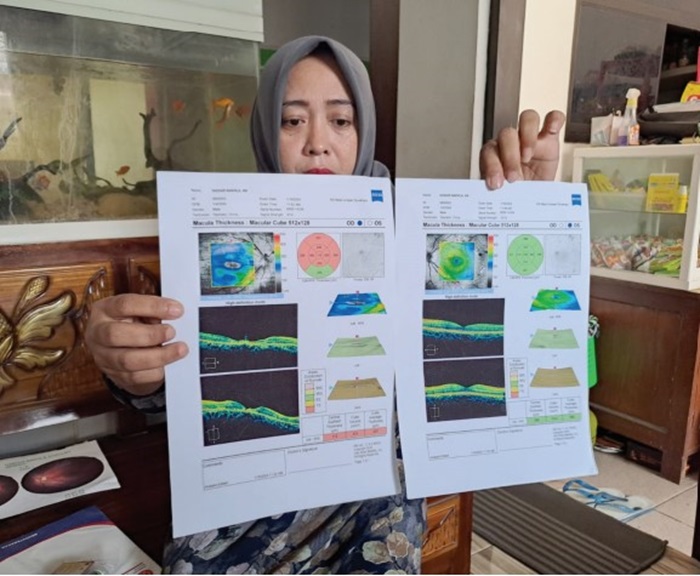 SEDIH: Erna menunjukkan hasil pemeriksaan mata ID akibat terlempar kayu di rumahnya, Kamis (14/2).