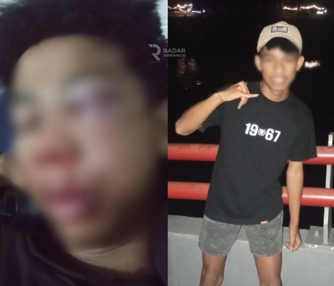 Kondisi  YA, yang jadi korban pengeroyokan gangster di Jembatan Ploso Jombang