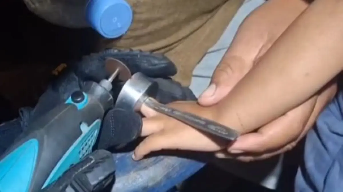 Regu 1 Damkarmat Gunungkidul sedang mengevakuasi jari balita yang terjepit tutup botol. (Dokumentasi Damkarmat Gunungkidul)