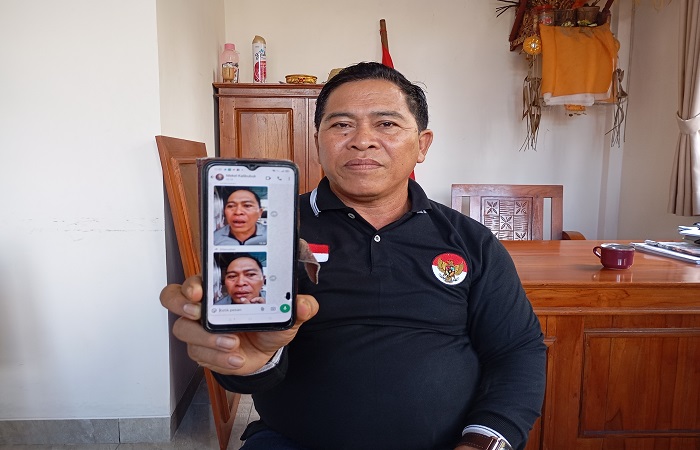 Perbekel Desa Selat, Putu Mara menunjukan foto dirinya yang juga terluka akibat pukulan dari Wisnawati.