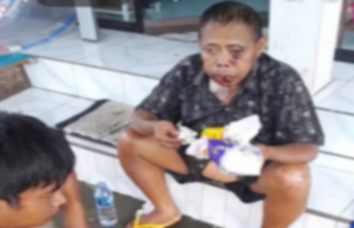Korban I Wayan Kajeng sesaat setelah menjadi korban tabrak lari. Ia diserempet sopir truk di jalur sebelas, Karangasem, sebelum dinyatakan meninggal dunia, kemarin.