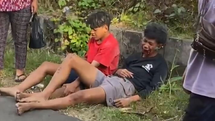 KORBAN TABRAK LARI: Dua orang remaja yang menjadi korban tabrak lari di Jalan Raya Pupuan-Seririt. Mereka ditinggalkan di wilayah Desa Titab, Buleleng.