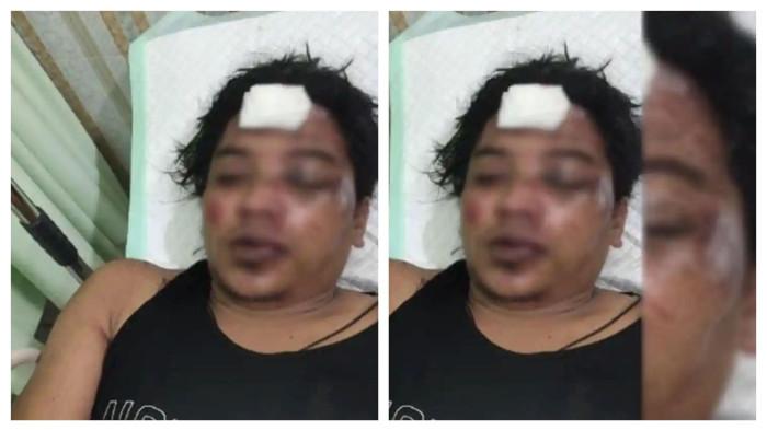 Tampang begal yang babak belur usai adu jotos dengan korbannya yang ternyata seorang atlet.