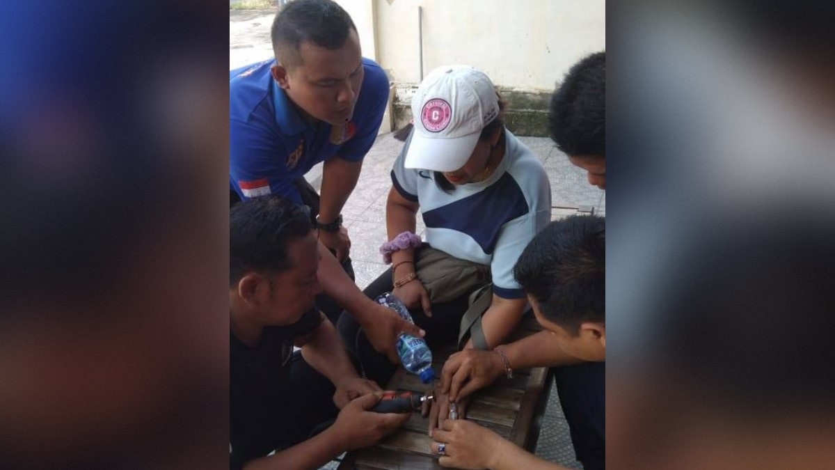 LEPAS CINCIN: Dinas Pemadam Kebakaran Buleleng melepas cincin yang membelit tangan seorang warga.