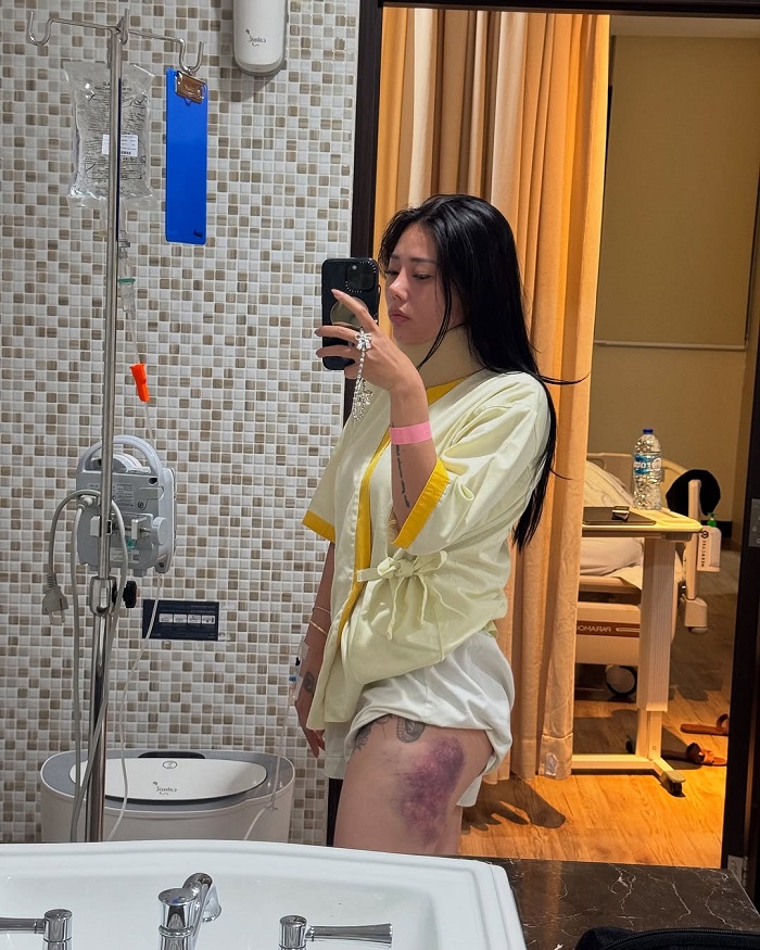 Wendy Walters Alami Cedera Kaki dan Leher Usai Tertabrak Jetski, Begini Kronologinya