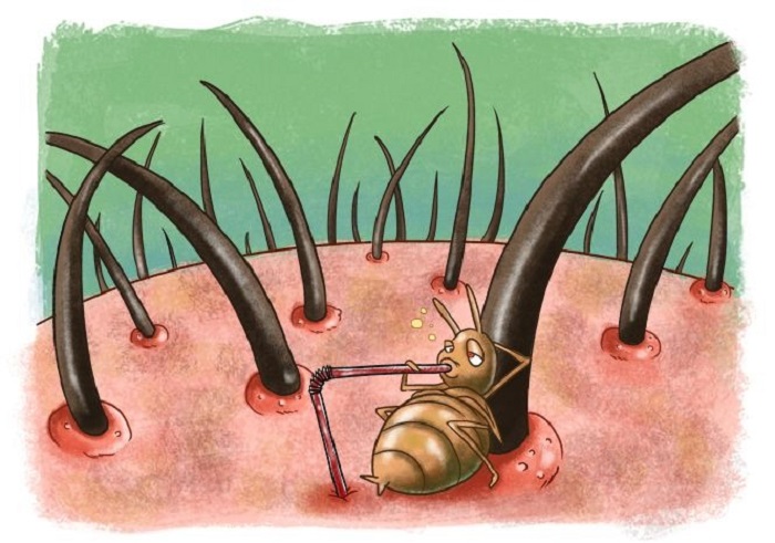 Ilustrasi Kutu Rambut