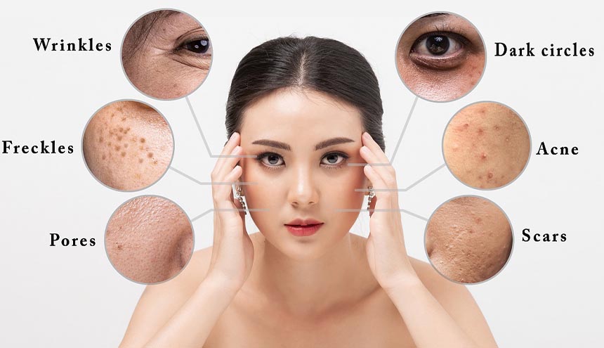 Kenapa Kulit Kusam Saat Ujian? Ini Dia Penyebab dan Solusinya