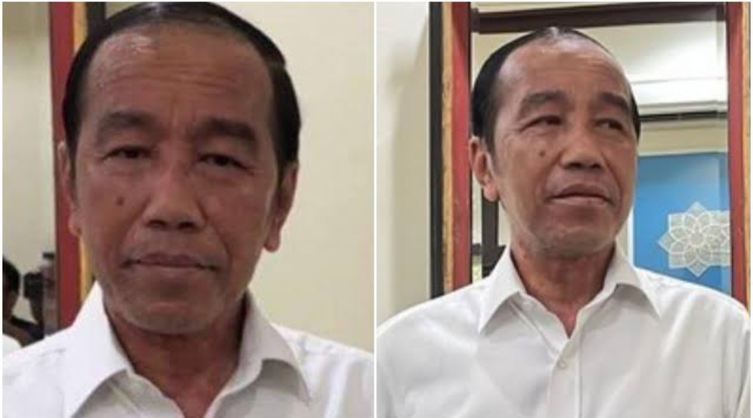 Kondisi Jokowi setelah sakit kulit (foto: youtube)