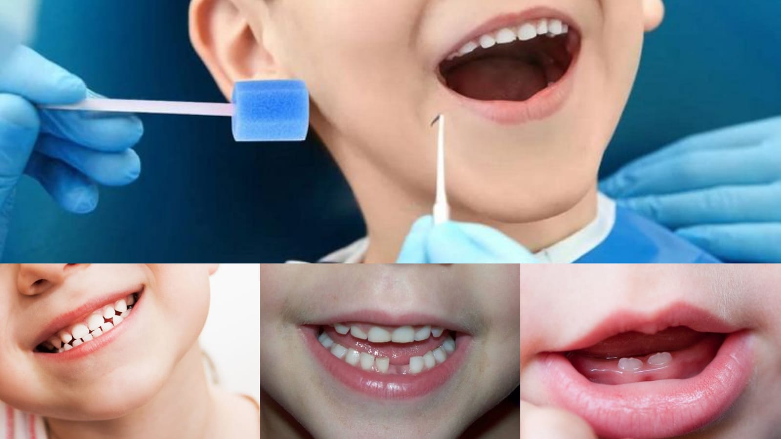 Children&rsquo;s Teeth