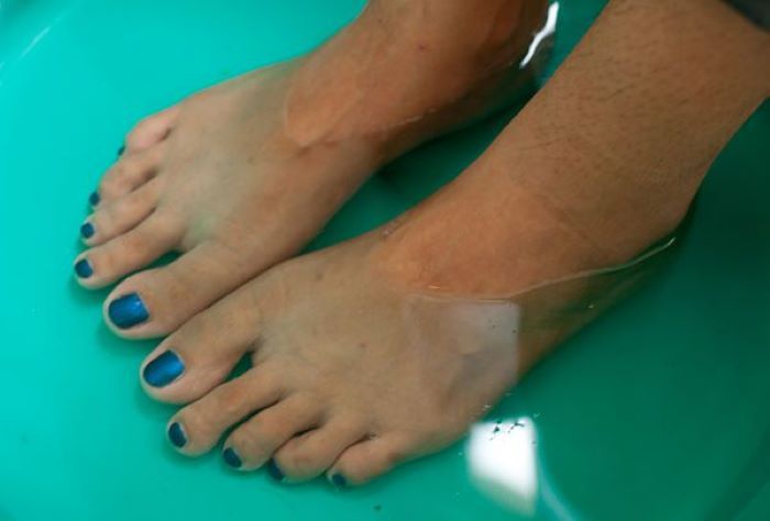Merendam kaki dengan air hangat dan larutan garam adalah terapi rumahan yang dapat meredakan rasa pegal