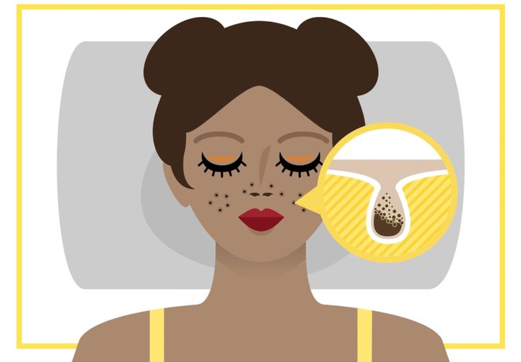 Ilustrasi bahaya tidak menghapus make up saat tidur