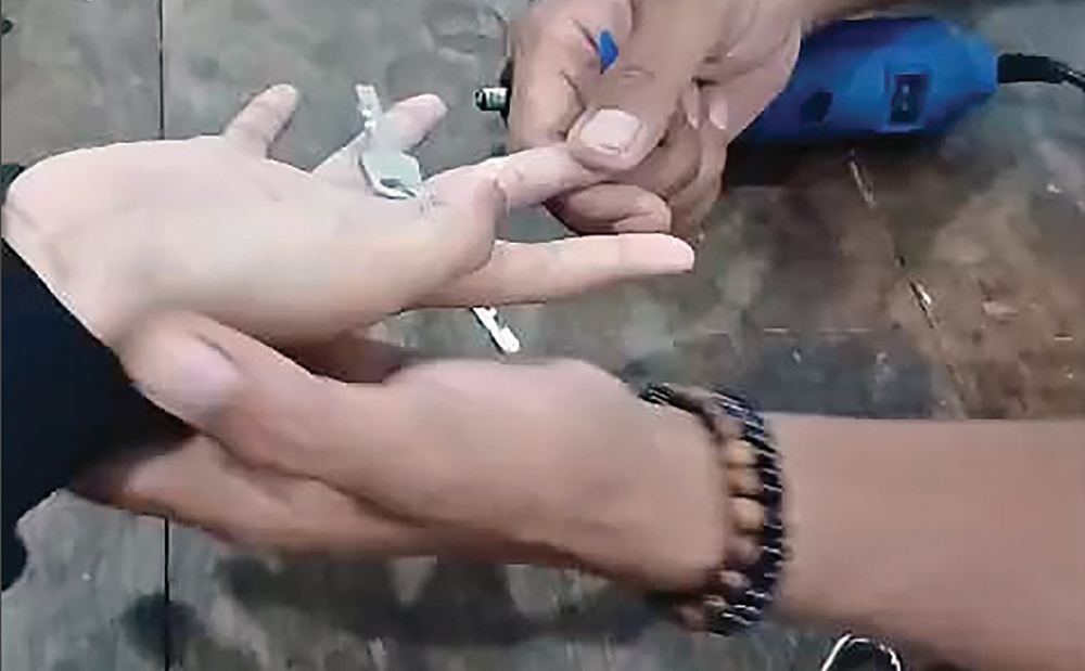 KESAKITAN: Damkarmat melepas gantungan kunci di jari Nadhira.