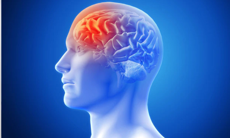 Ilustrasi brain rot