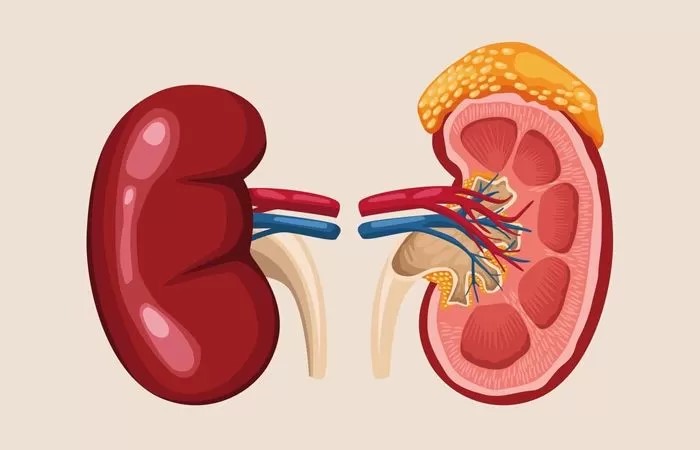 Penderita ginjal harus berhati-hati dalam mengonsumsi makanan.