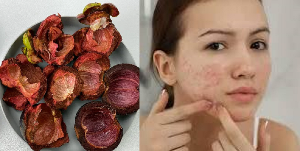 Kulit manggis dapat dimanfaatkan untuk kesehatan kulit dan kecantikan wajah.