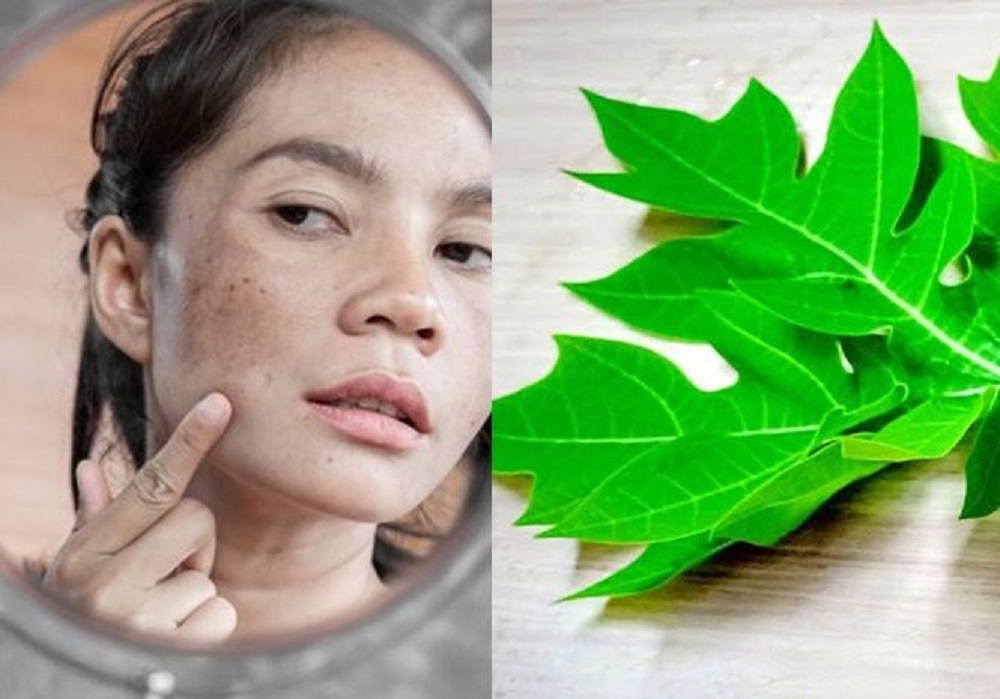 Daun pepaya diketahui memiliki banyak nutrisi yang bisa dimanfaatkan sebagai bahan alami perawatan kecantikan.