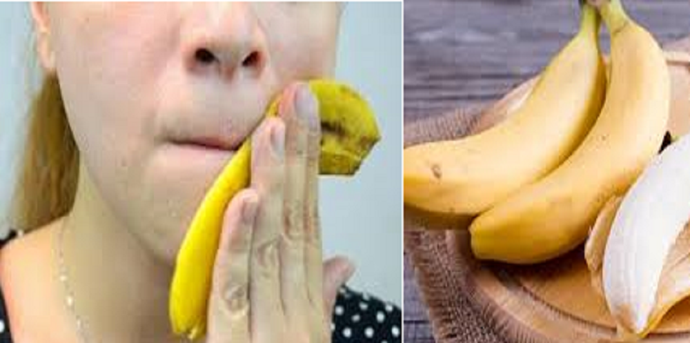 Tidak hanya daging buahnya, kulit pisang juga mengandung berbagai nutrisi yang bermanfaat bagi tubuh. Salah satunya untuk perawatan kulit wajah.