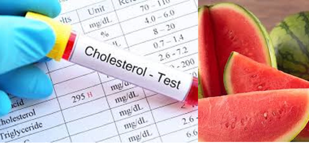 Perbanyak mengonsumsi buah-buahan baik untuk kesehatan. Termasuk buah semangka untuk menurunkan kadar kolesterol.