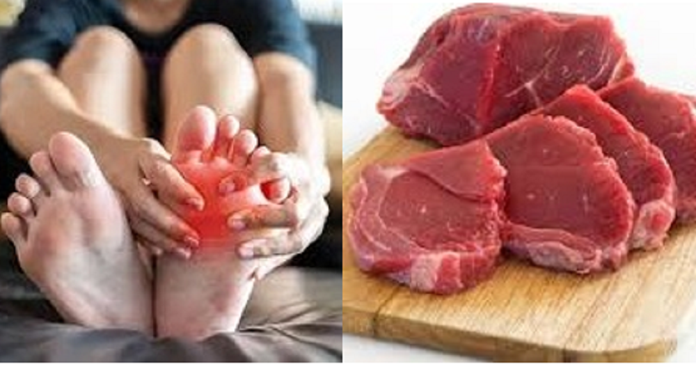 Untuk penderita asam urat, penting untuk membatasi atau menghindari konsumsi makanan tinggi purin. Salah satunya daging sapi.