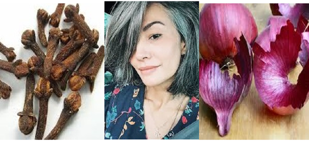 Racikan untuk mengatasi uban cukup menggunakan dua bahan saja berupa kulit bawang merah dan cengkih.