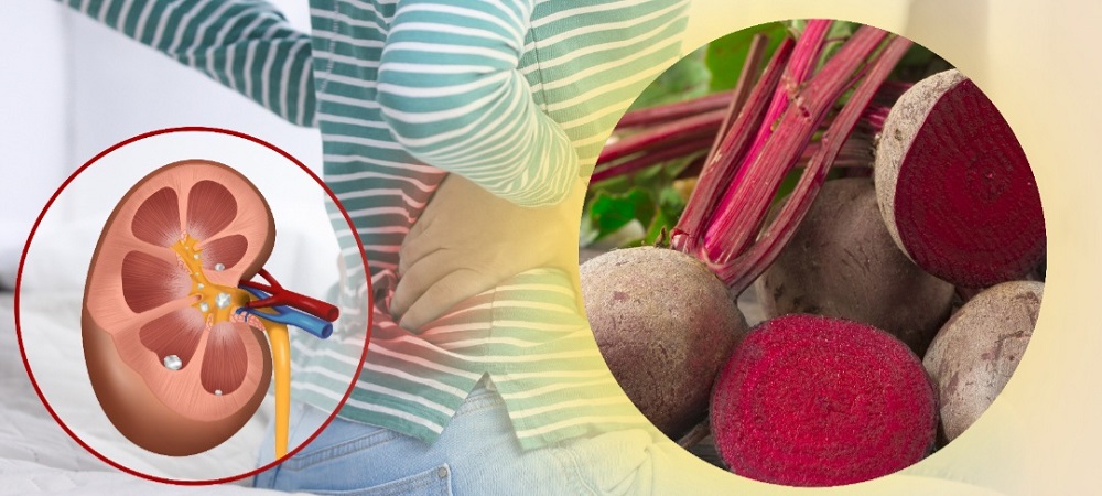 Buah Bit dikenal sebagai salah satu sumber makanan bergizi berkat kandungan nutrisinya yang melimpah.