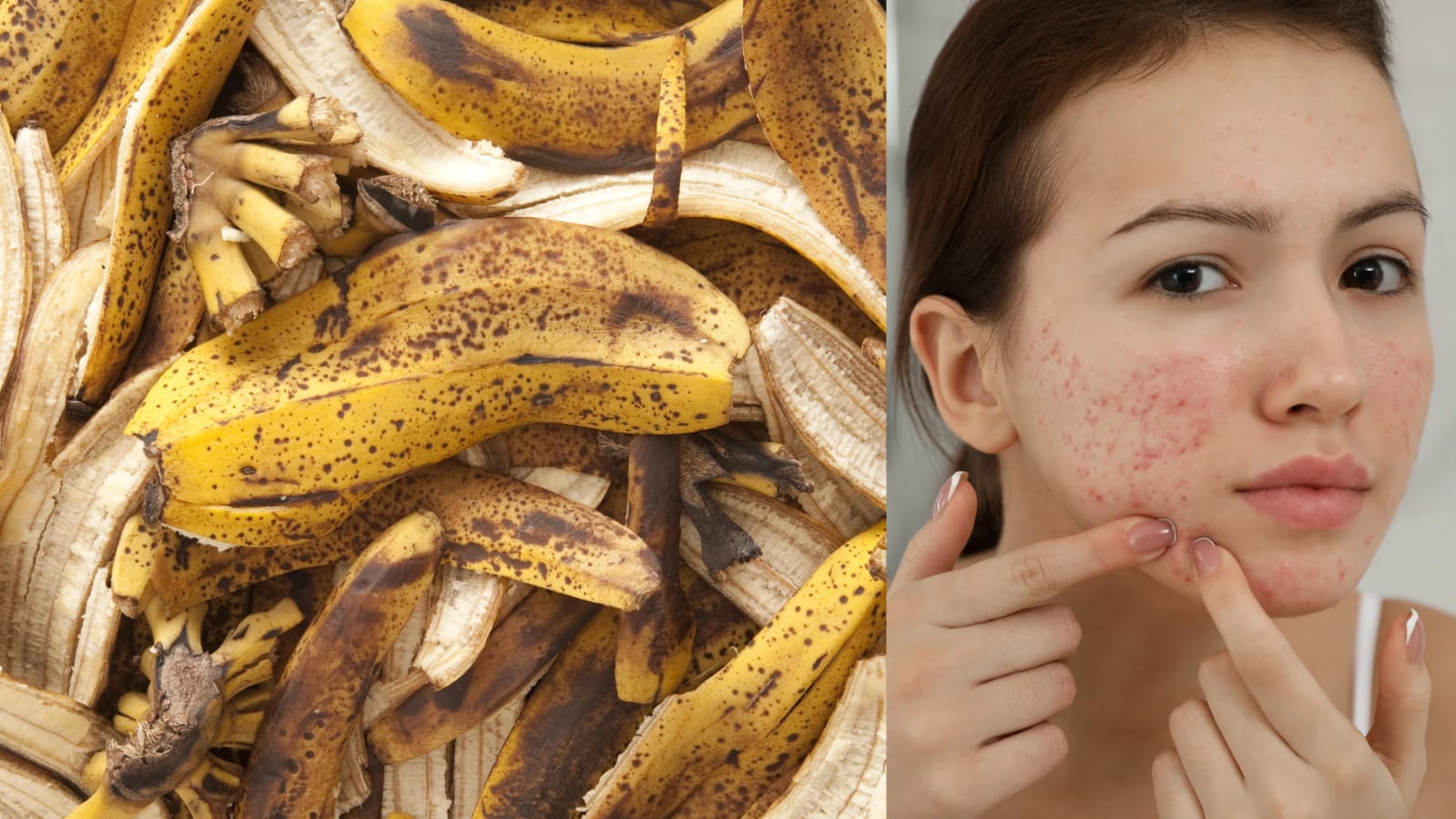 Tidak hanya buahnya, ternyata kulit pisang juga bermanfaat untuk kesehatan