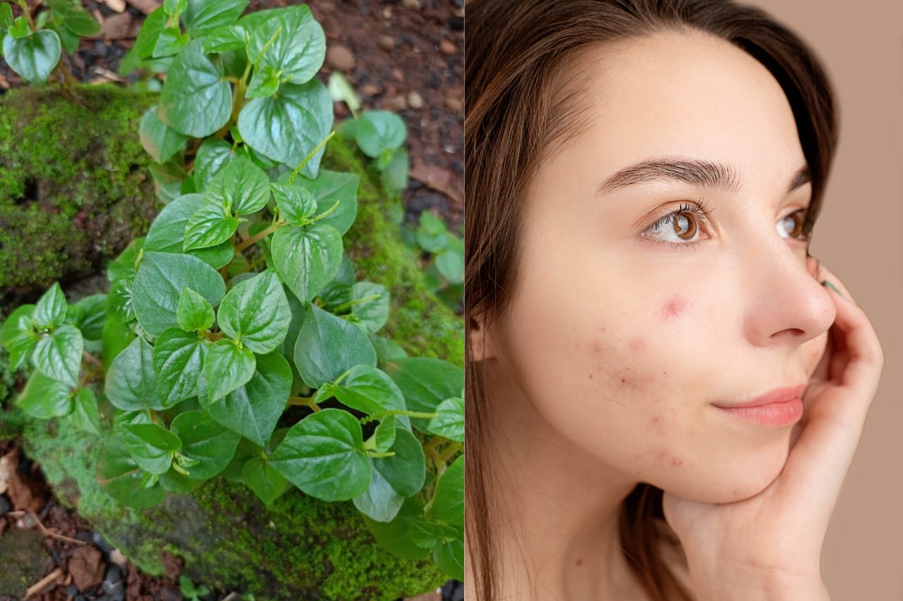 Sirih cina bermanfaat untuk kecantikan wajah, salah satunya yaitu meredakan jerawat