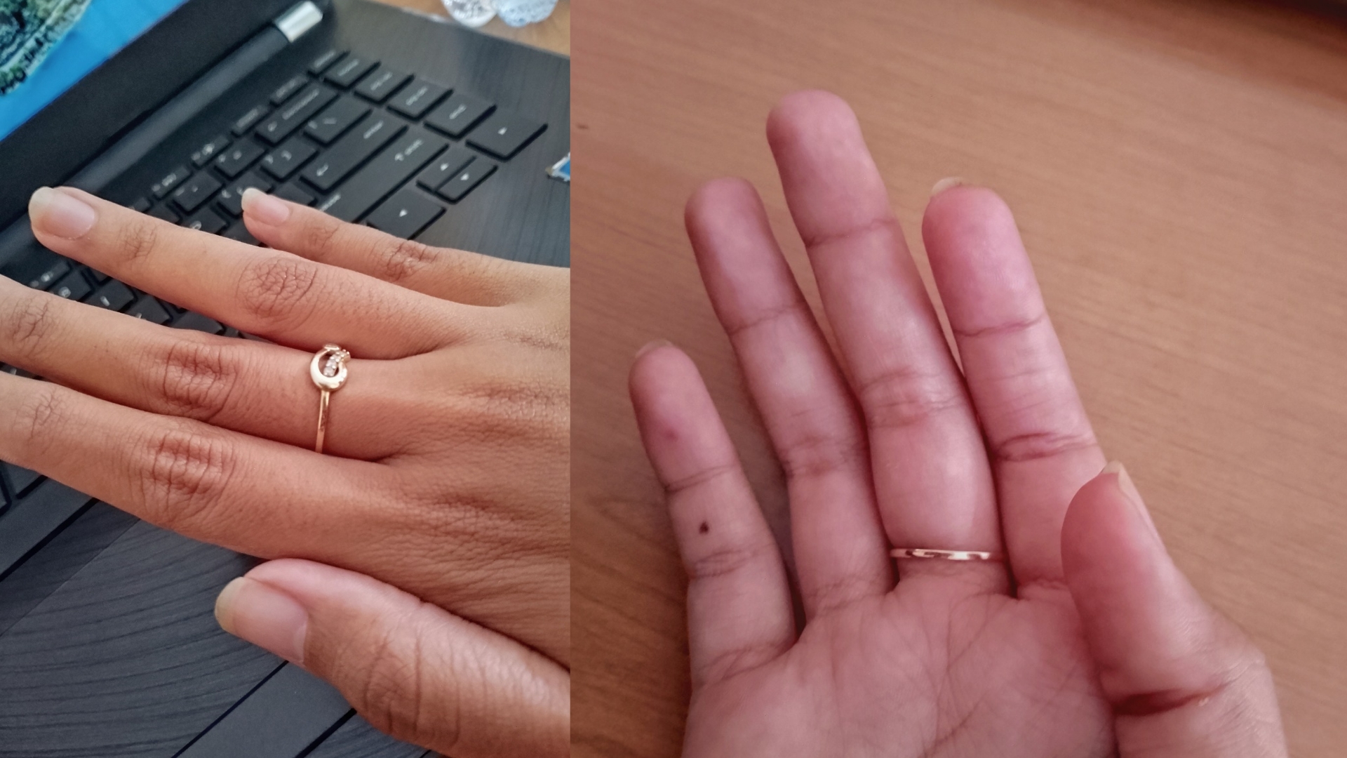 Tips melepas cincin yang kekecilan